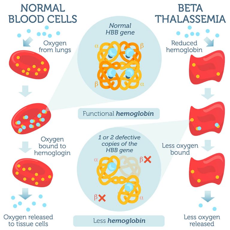 Beta Thalassemia DNA Test DNA Access Lab