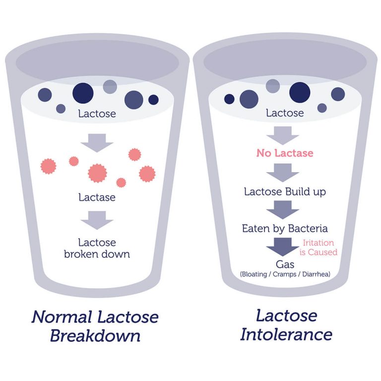 Lactose Intolerance DNA Test (1 SNP) DNA Access Lab