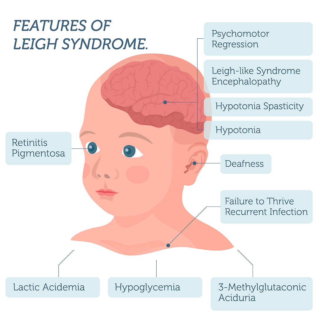 Leigh Syndrome DNA Test – DNA Access Lab